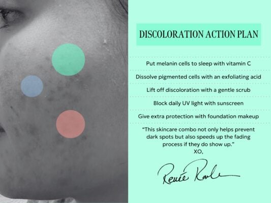 Types of Skin Discoloration & How to Get Rid of Them Fast routine for skin discoloration