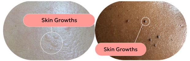 An Esthetician's Guide to Achieving Glass Skin skin with skin growths